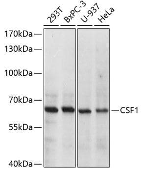 CSF1 / MCSF Antibody