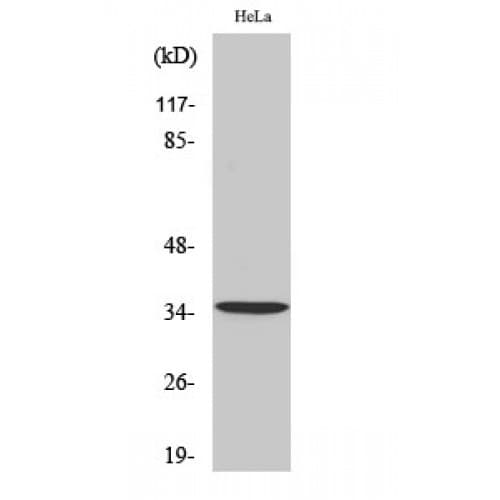 TPM1 / Tropomyosin Antibody (N-Terminal)