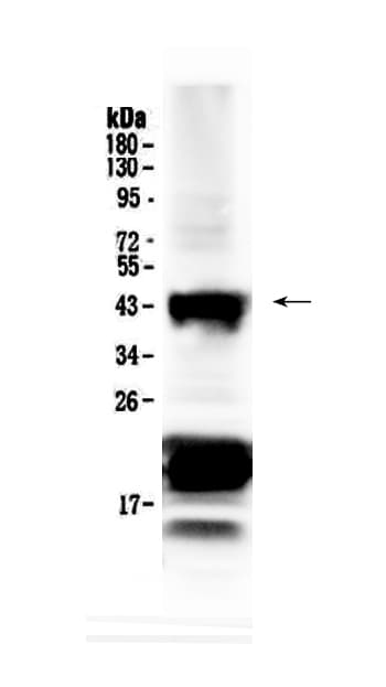 VSX2 / CHX10 Antibody