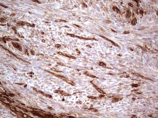 LGALS9 / Galectin 9 Antibody (clone OTI1D12)
