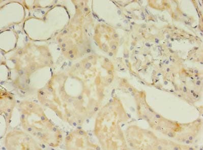 TSGA13 Antibody