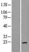RPL26 / Ribosomal Protein L26 (Over-Expression Lysate Myc-DDK (Flag))