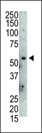 MDM2 Antibody (aa393-424)