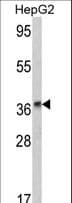 ADH2 / ADH1B Antibody (aa209-237)