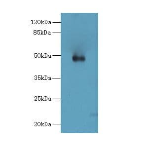 ZNF232 Antibody