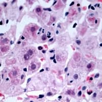 Polyclonal Rabbit anti-Human NDRG4 Antibody (Internal, IHC, WB)