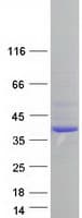 Human SAE1 Protein (Recombinant Myc-DDK (Flag))