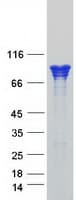 Human CTNNA1 / Catenin Alpha-1 Protein (Recombinant Myc-DDK (Flag))