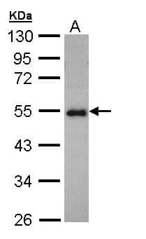 Polyclonal Rabbit anti-Human CCDC83 Antibody (aa67-276, IHC, WB)
