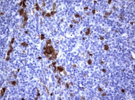 Monoclonal Mouse anti-Human TS / Thymidylate Synthase Antibody (clone OTI1B1, IHC, WB)