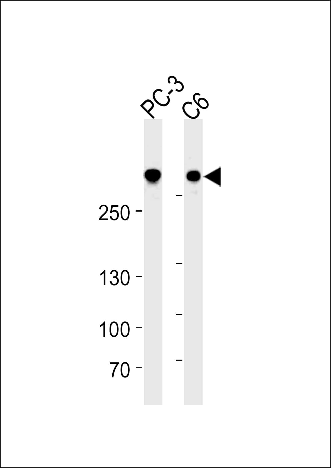 Monoclonal Mouse anti-Human FLNA / Filamin A Antibody (clone 1273CT424.104.153, WB)