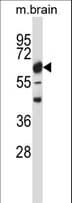 CAMK2B / CaMKII Beta Antibody (aa168-196)