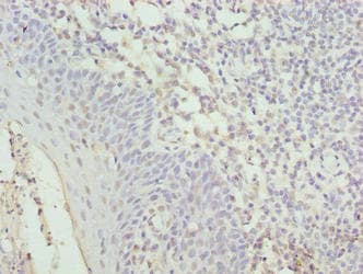 Polyclonal Rabbit anti-Human C17orf62 Antibody (IHC, WB)