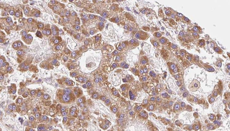 SLC16A6 / MCT6 Antibody