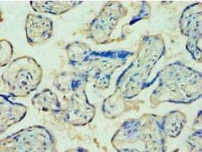 Polyclonal Rabbit anti-Human TDP1 Antibody (aa1-260, IHC, WB)