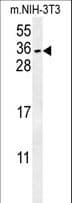 Polyclonal Rabbit anti-Human CITED2 Antibody (aa200-226, WB)