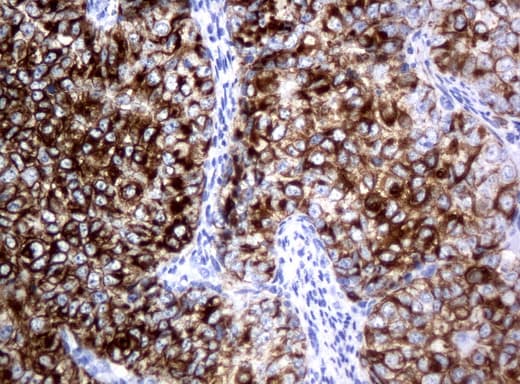 Monoclonal Mouse anti-Human KRT18 / CK18 / Cytokeratin 18 Antibody (clone UMAB50, Carrier-free, aa69-372, IHC, IF, WB)