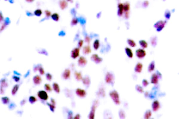 JUN / c-Jun Antibody (phospho-Thr91)