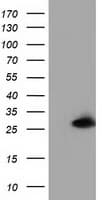 GSTT2 Antibody (clone OTI4F9)