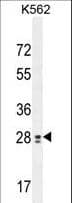 TEX13B Antibody (aa276-305)