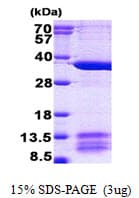 Human BM022 / MRPL1 Protein (Recombinant His)