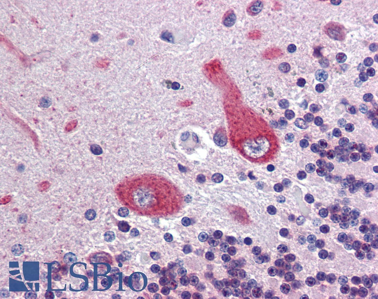 IHC-plus™ Polyclonal Goat anti-Human ANK3 / ANKYRIN-G Antibody (aa1690-1701, IHC)