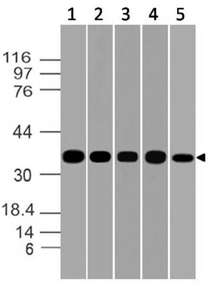 IHC-plus™ Monoclonal Mouse anti-Human GAPDH Antibody (clone ABM22C5, aa120-320, IHC, WB)