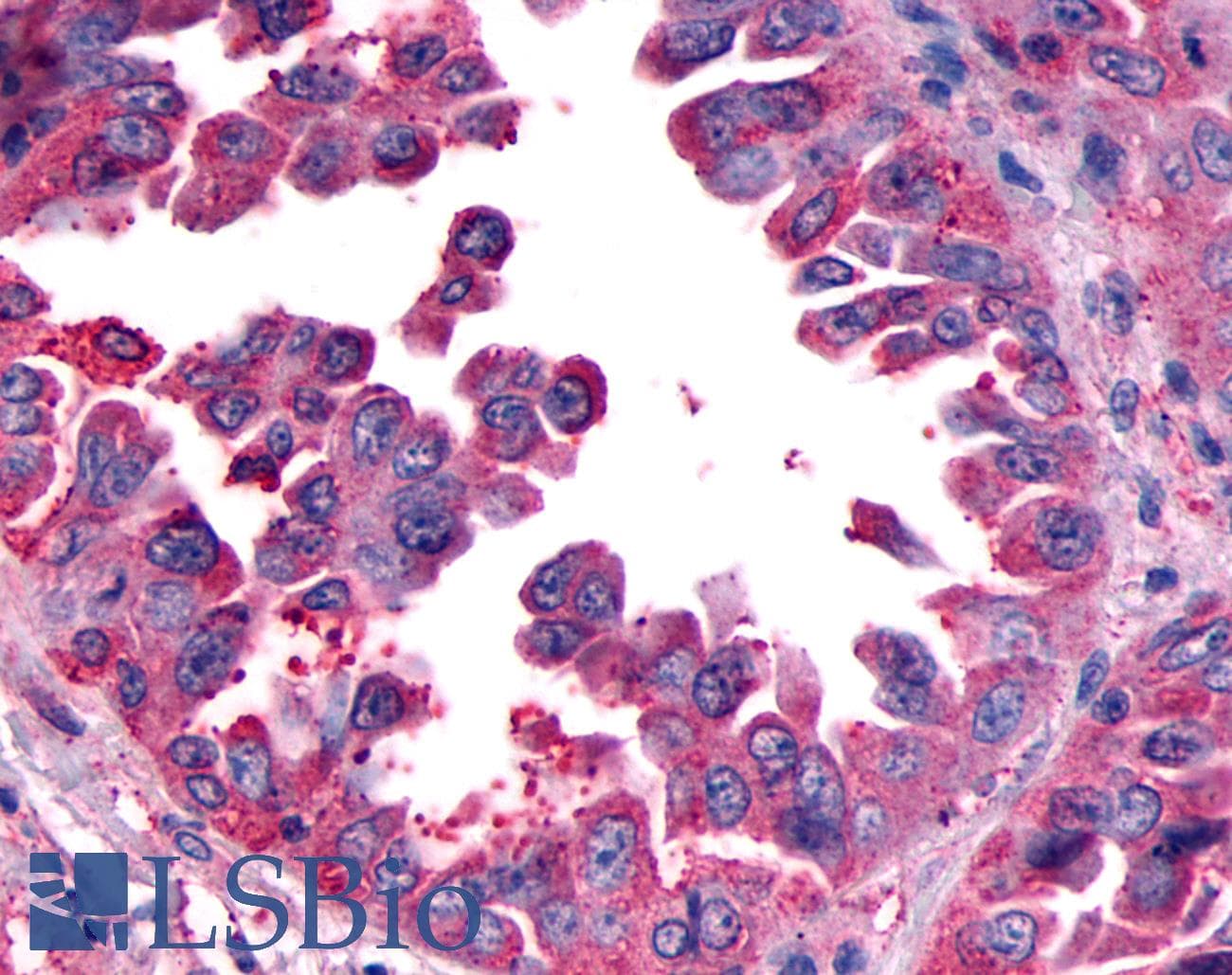 PathPlus™ Polyclonal Rabbit anti-Human CALCRL / CGRP Receptor Antibody (N-Terminus, IHC)