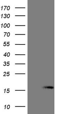 NPPB / BNP Antibody (aa27-102, clone OTI11C3)