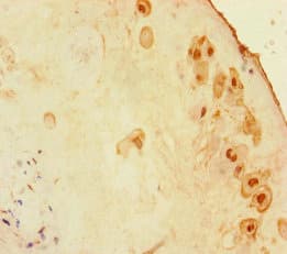 ZNF366 Antibody