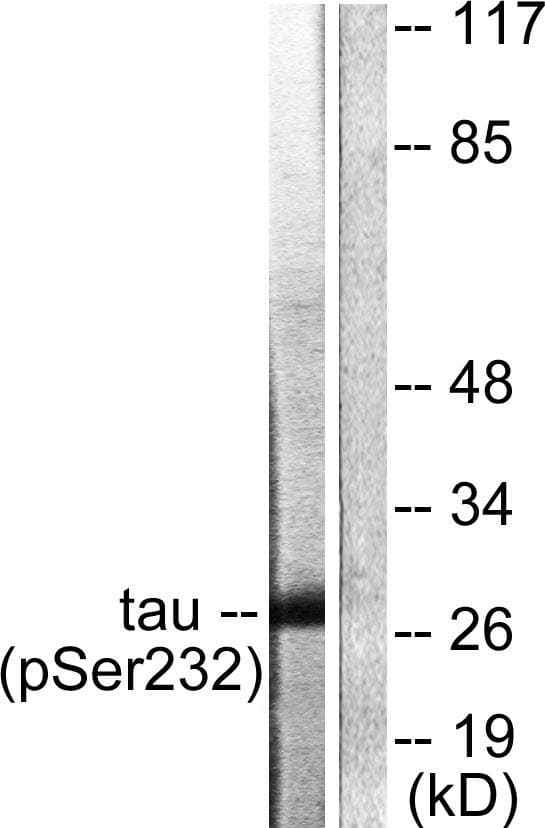 YWHAQ / 14-3-3 Theta Antibody (phospho-Ser232)