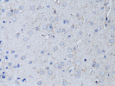 RYR2 / Ryanodine Receptor 2 Antibody