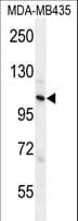 Polyclonal Rabbit anti-Human ZC3H3 Antibody (aa920-948, IHC, WB)
