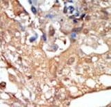Polyclonal Rabbit anti-Human RAF1 / RAF Antibody (aa1-30, IHC, IF, WB)
