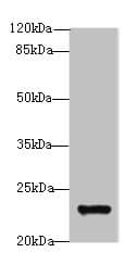 GAJ / MND1 Antibody