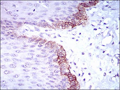 Monoclonal Mouse anti-Human BRCA1 Antibody (clone 6C6D2, aa229-335, IHC, WB)
