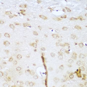 Polyclonal Rabbit anti-Human UBE2L3 / UBCH7 Antibody (IHC, WB)