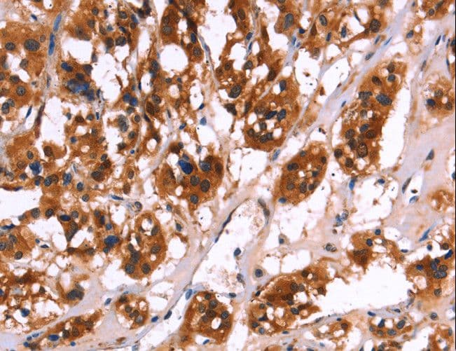 CALB1 / Calbindin Antibody