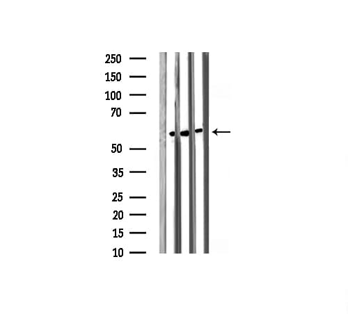 SRC Antibody (phospho-Tyr418)