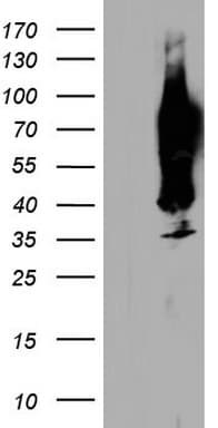 CEACAM5 / CD66e Antibody (aa35-680, clone OTI9F9)