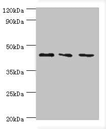 Polyclonal Rabbit anti-Human YKL39 / CHI3L2 Antibody (aa27-390, IHC, WB)