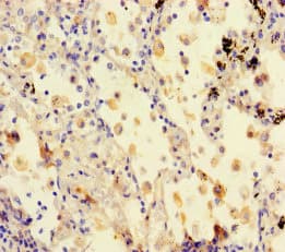 Amisyn / STXBP6 Antibody (aa2-210)