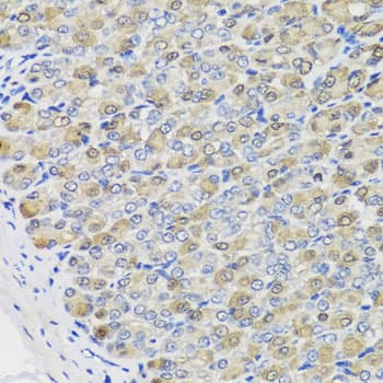 Polyclonal Rabbit anti-Human CBR3 Antibody (IHC, IF, WB)