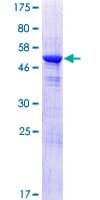 Human MAWDBP / PBLD Protein (Recombinant GST)