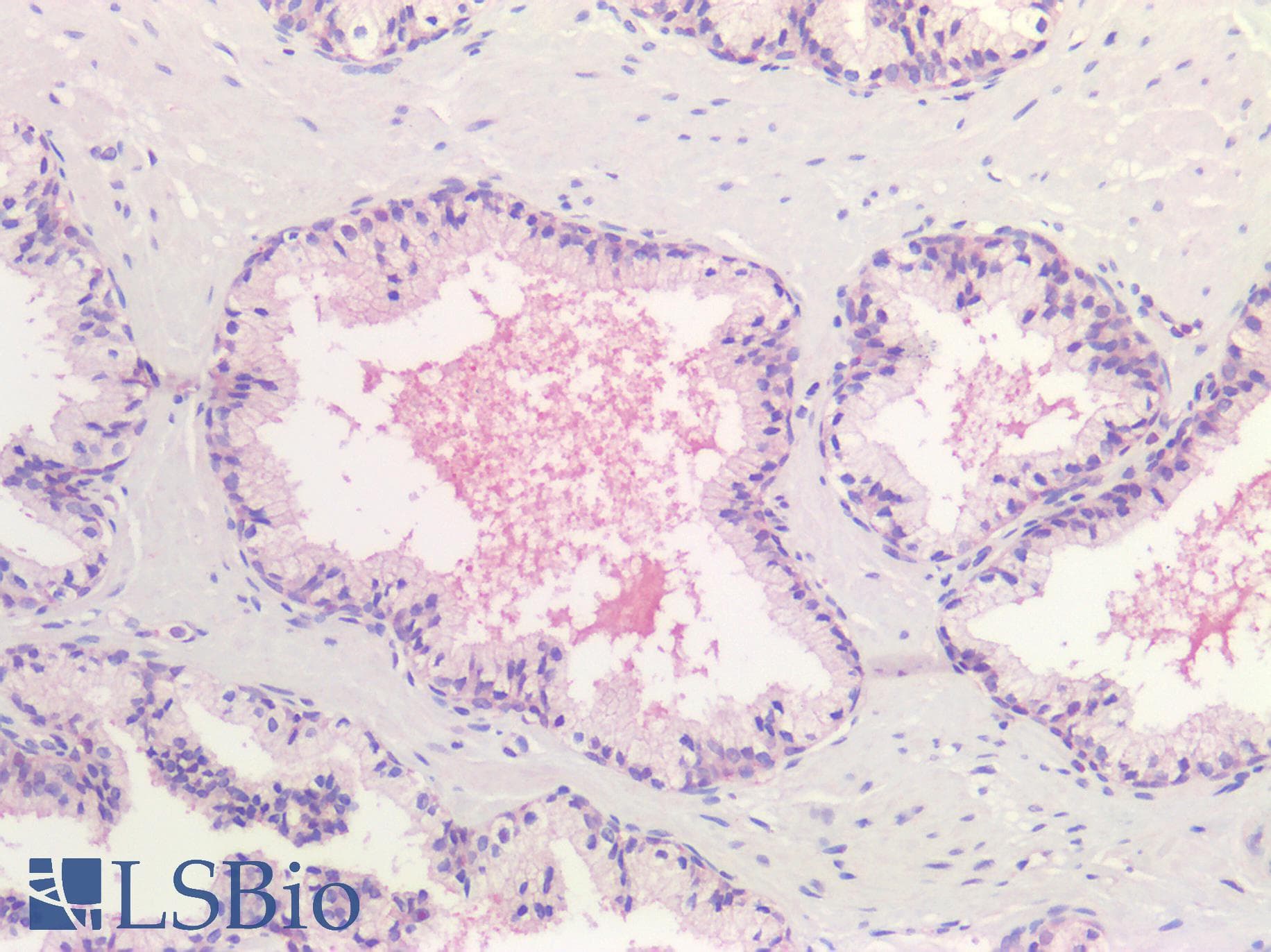 IHC-plus™ HDAC6 Antibody