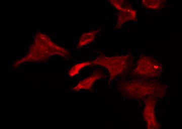 CHRNB1 Antibody