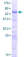 Human ERI1 / HEXO Protein (Recombinant GST)