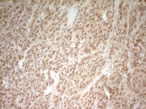 HMG20A Antibody (aa1-281, clone OTI1C2, Carrier-free)