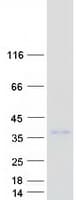 Human RCHY1 / PIRH2 Protein (Recombinant Myc-DDK (Flag))