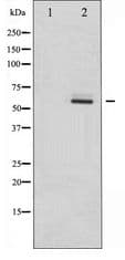 Polyclonal Rabbit anti-Human ESR2 / ER Beta Antibody (IF, WB)
